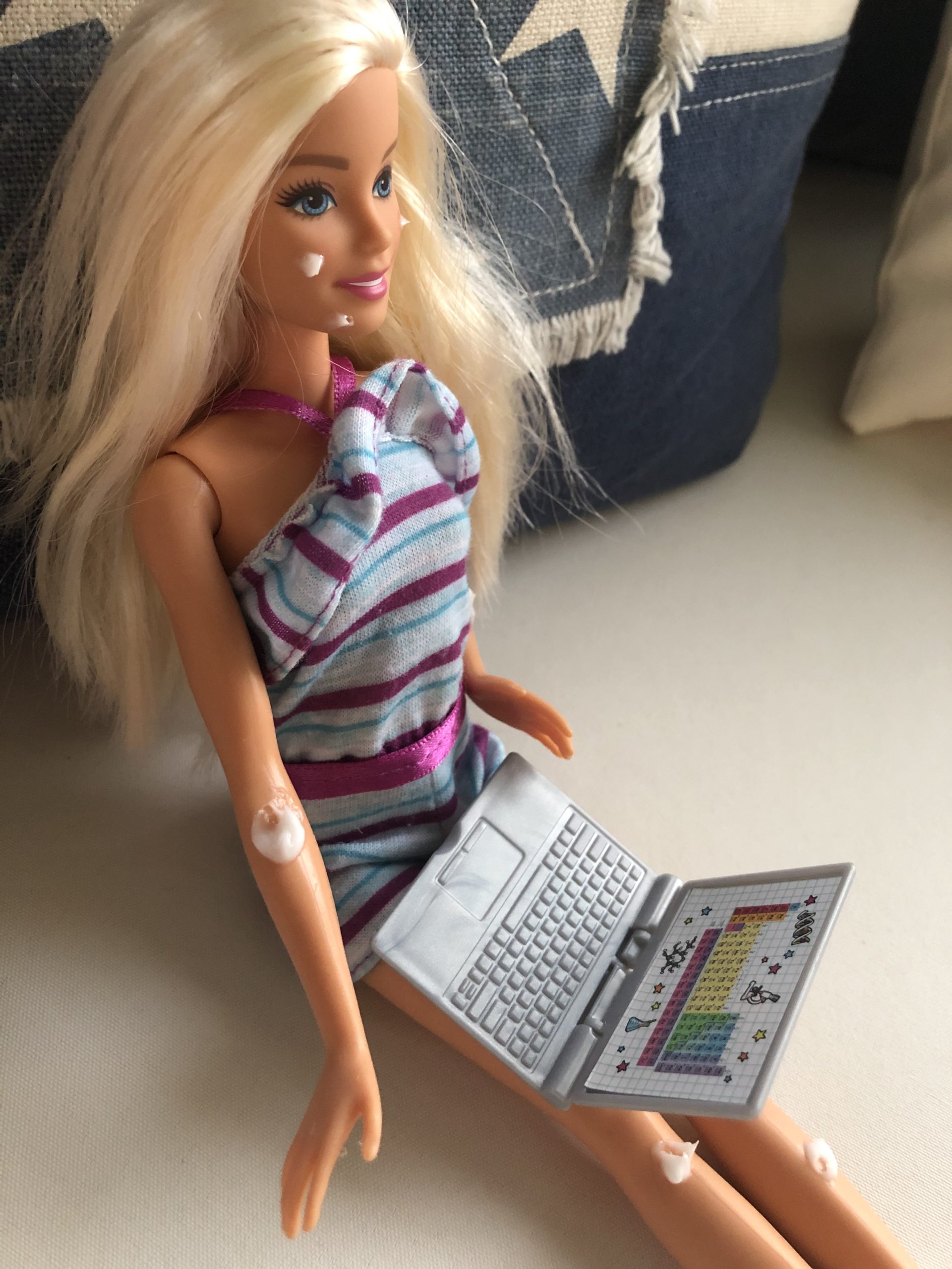 A Barbie Doll with a computer on her lap. she has spots of white cream on her face because she has poison ivy in the Barbie Story, The Spotted Day.